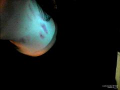 thats my neck after a very.. raucous night o.O