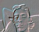 antony xray1