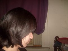 side of my head?
